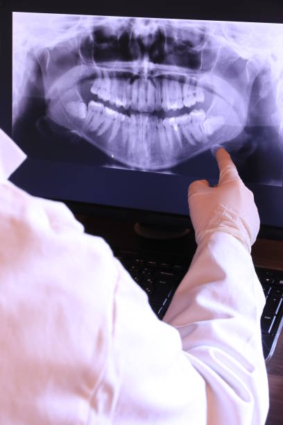 Best Emergency Wisdom Teeth Removal in George West, TX