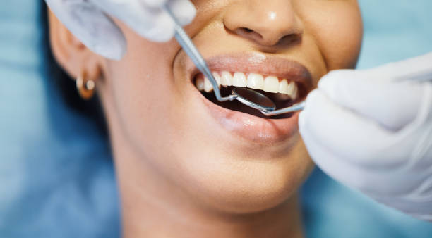 Best Emergency Dental Care for Broken or Chipped Teeth in George West, TX