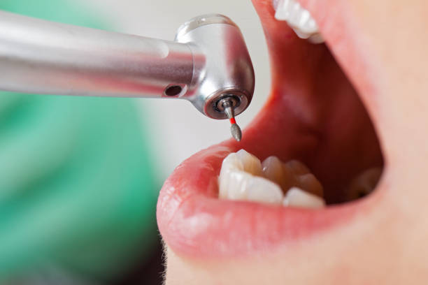 Best Same-Day Emergency Dental Services in George West, TX